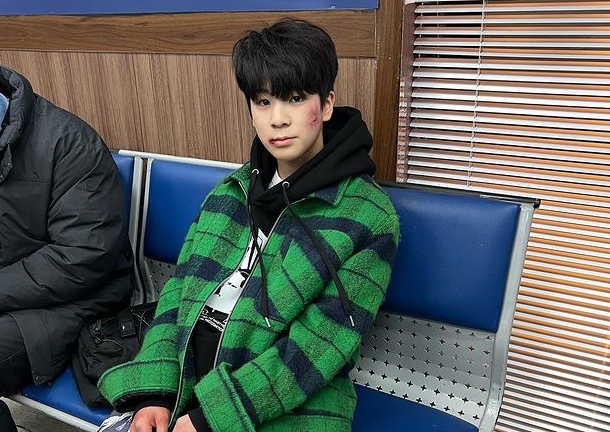 검찰 송치된 16세 정동원, 전과 안 남는 제도 있는데 굳이 거부했다…왜?