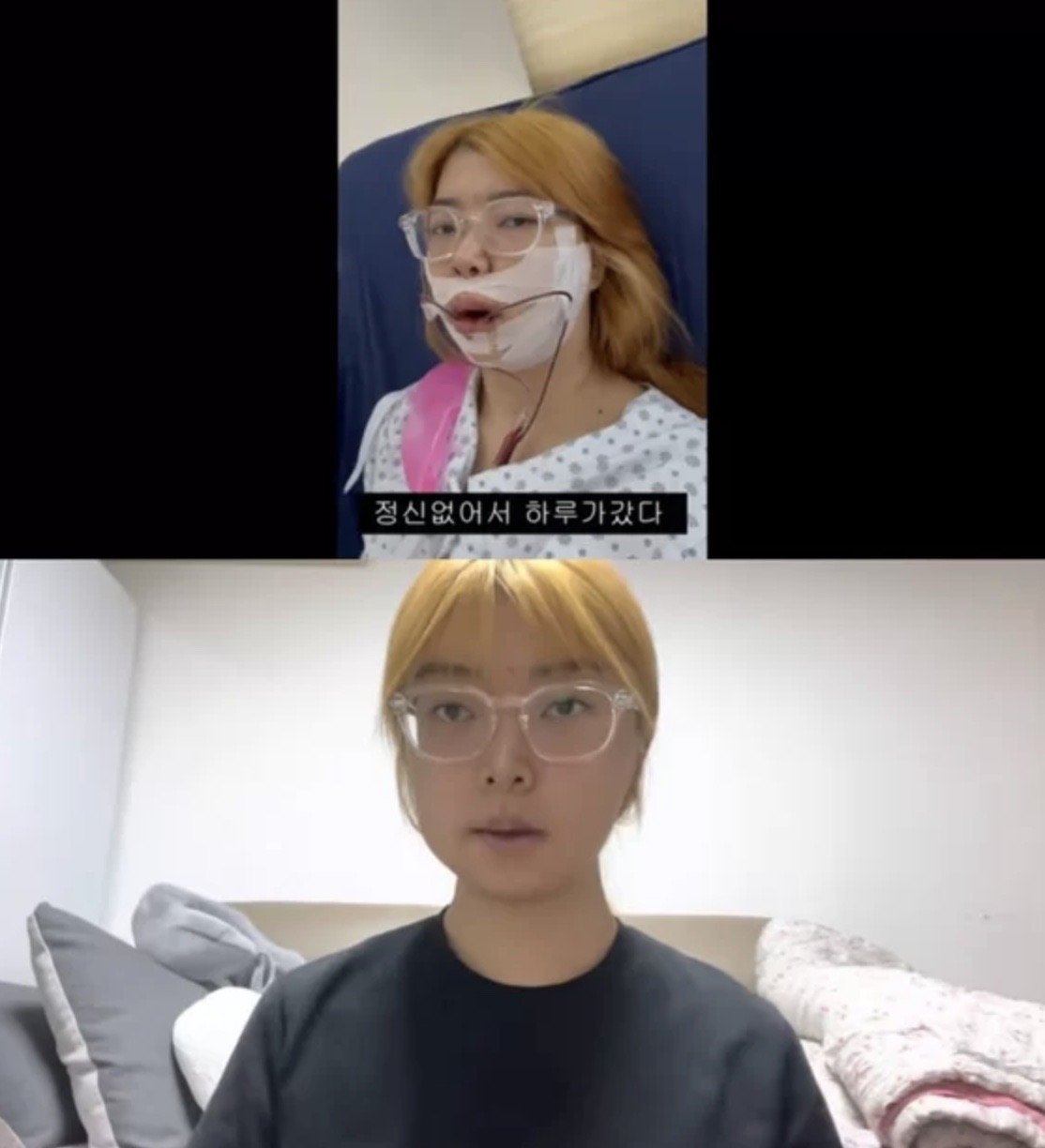 ‘나는솔로’ 10기 영자, 양악수술한 이유는?