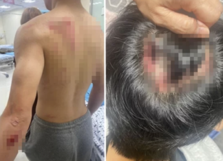 “운동하던 중3 아들, 칼부림 범인으로 몰았다”…피범벅에 부모 분노