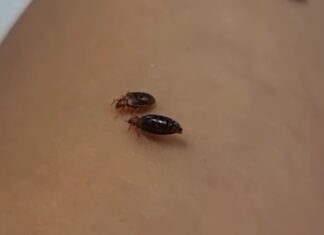 빈대 물렸을 때 무슨 약 발라야 할까? 빈대