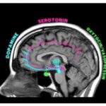 Sex_in_MRI_scan