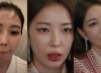 ‘내남결’ 보아, 입술 성형 논란에 결국…