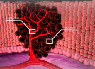 꼬릿꼬릿한 “이냄새”맡으면 암과 알츠하이머병에 위험 줄여준다. 냄새만으로 암과 알츠하이머를 예방할 수 있다.