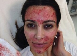 얼굴에 뱀파이어 주사 맞았다가 HIV 감염된 여자들