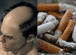담배 많이 피우면 탈모 온다는 말, 과연 진짜일까? 탈모 담배 흡연
