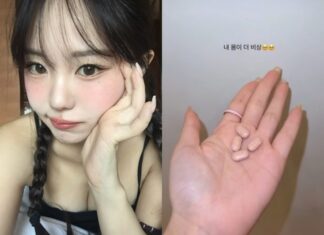 “내 몸이 더 비상” 홍영기, 윤석열 비상계엄에도 ‘마이웨이’