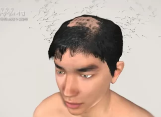 자주 마시면 탈모 쉽게 온다는 이 음료수 탈모