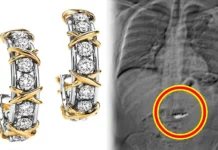 11억짜리 티파니 다이아 귀걸이 삼킨 도둑…어떻게 회수할까?